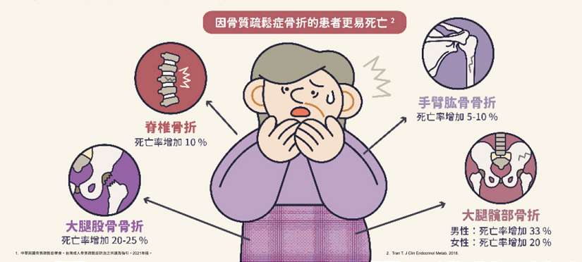 骨質疏鬆不可輕忽 可能失去行動力